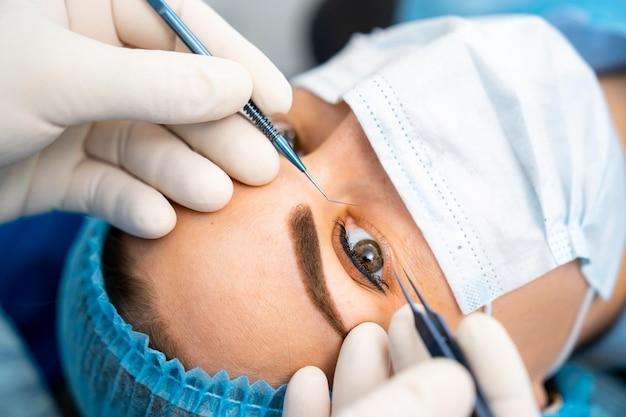 non invasive laser eye surgery