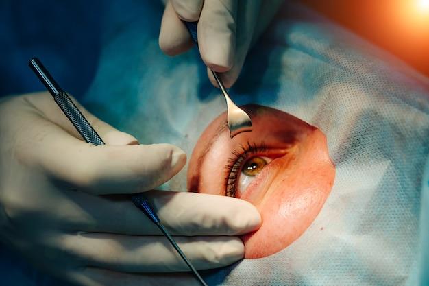 non invasive laser eye surgery