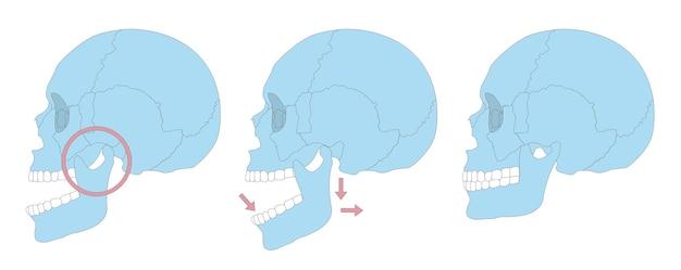 Do Humans Have One Or Two Jaws 