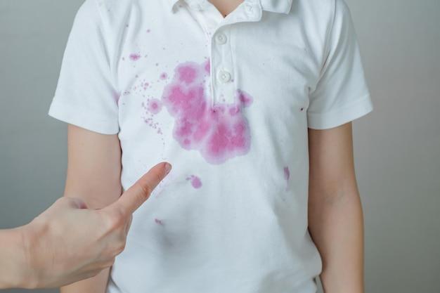  How To Remove Rubber Stains From Clothes 