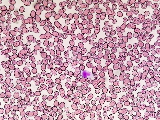  What Does Coccidia Look Like In Stool 